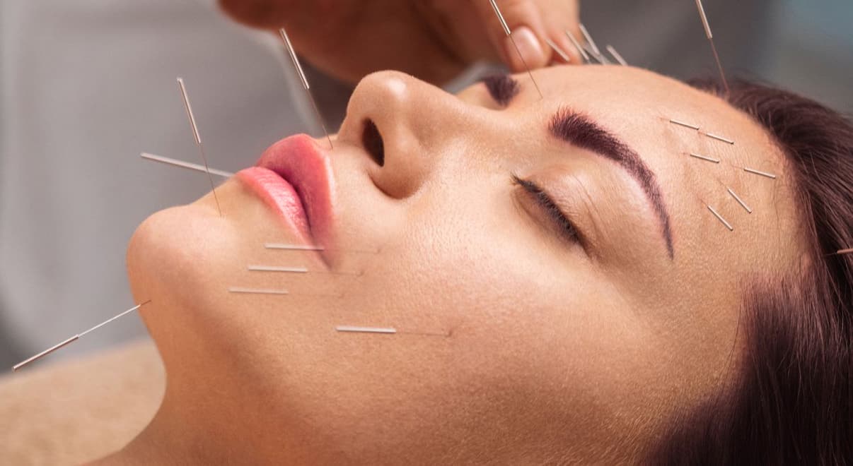 Αντιγήρανση και βελονισμός προσώπου